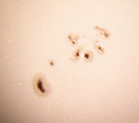 Inflation in der Kosmologie